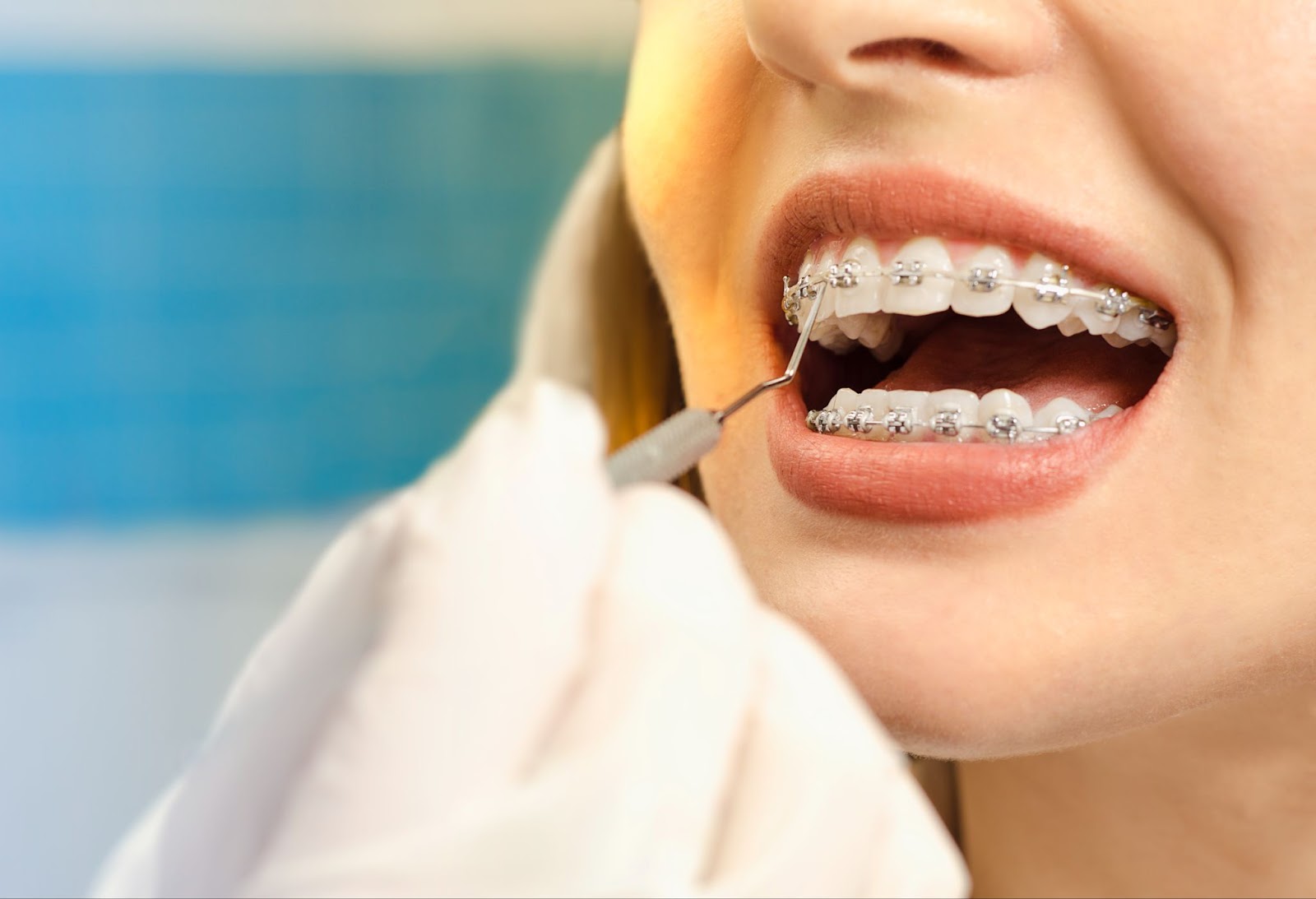 Why Spanish Fork, UT is the Perfect Place for Your Orthodontic Treatment