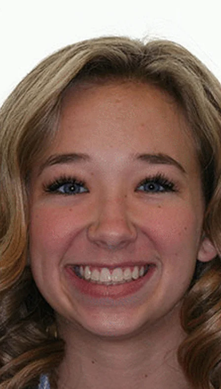 orthodontist spanish fork