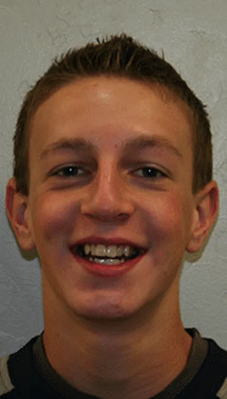 orthodontist spanish fork