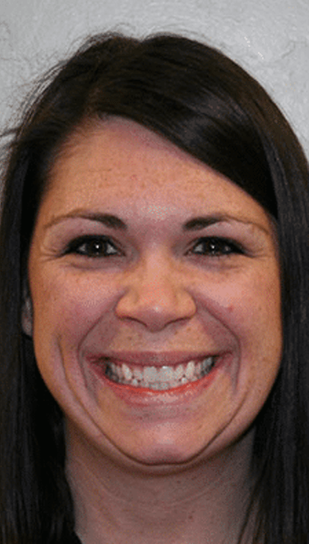 orthodontist spanish fork