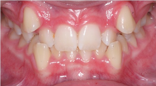 before Image
