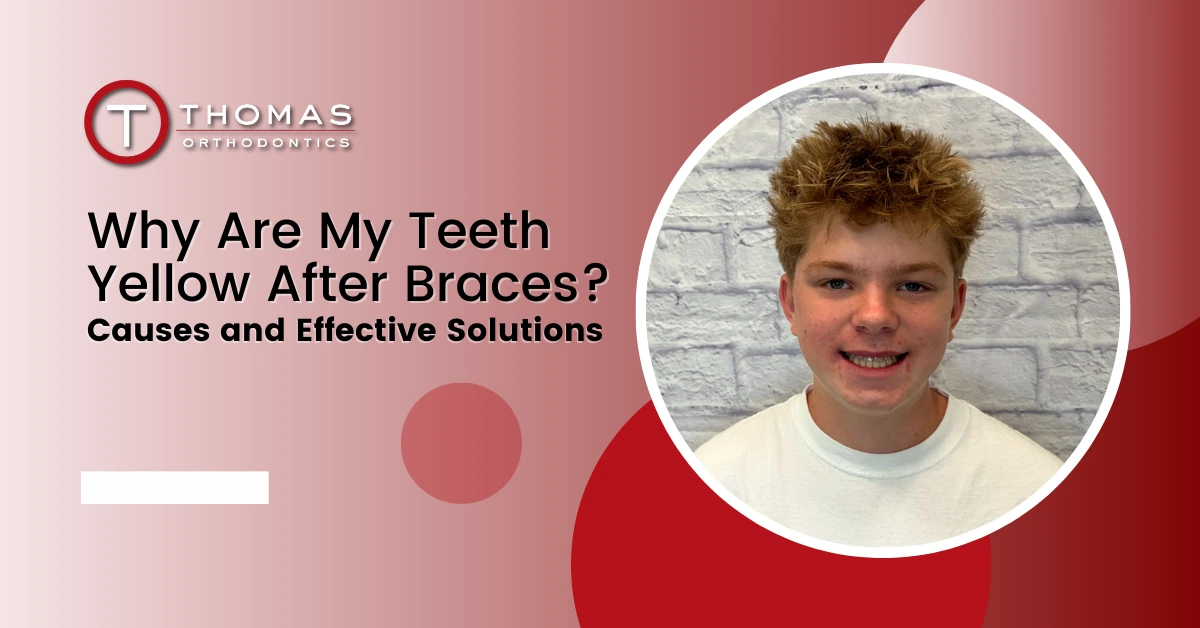 spanish fork braces