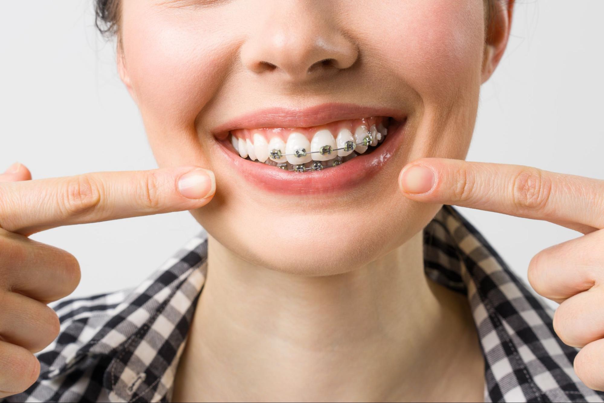 What Happens After Your Orthodontic Consultation?