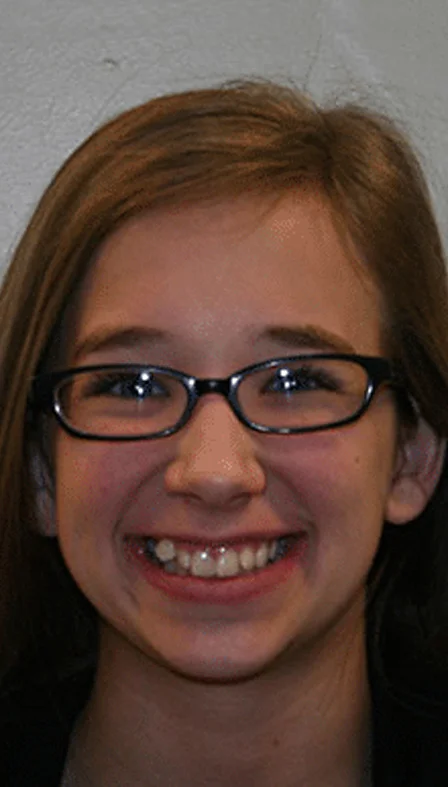 Girl with glasses smiling before orthodontic braces treatment.