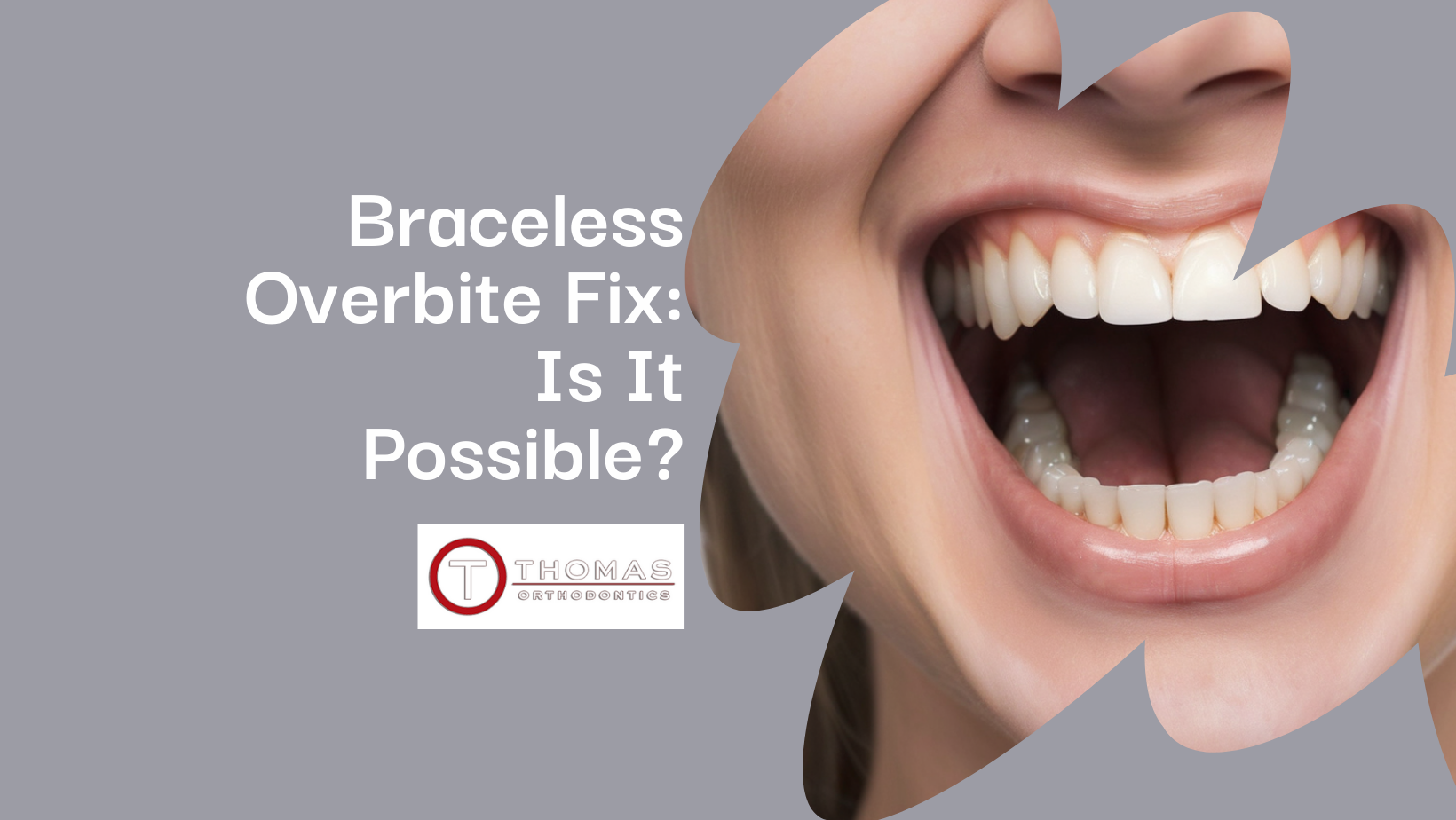 Fixing Overbites Without Braces Learn More!