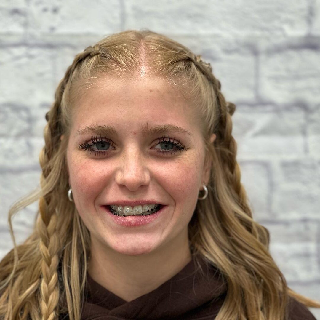 orthodontics spanish fork