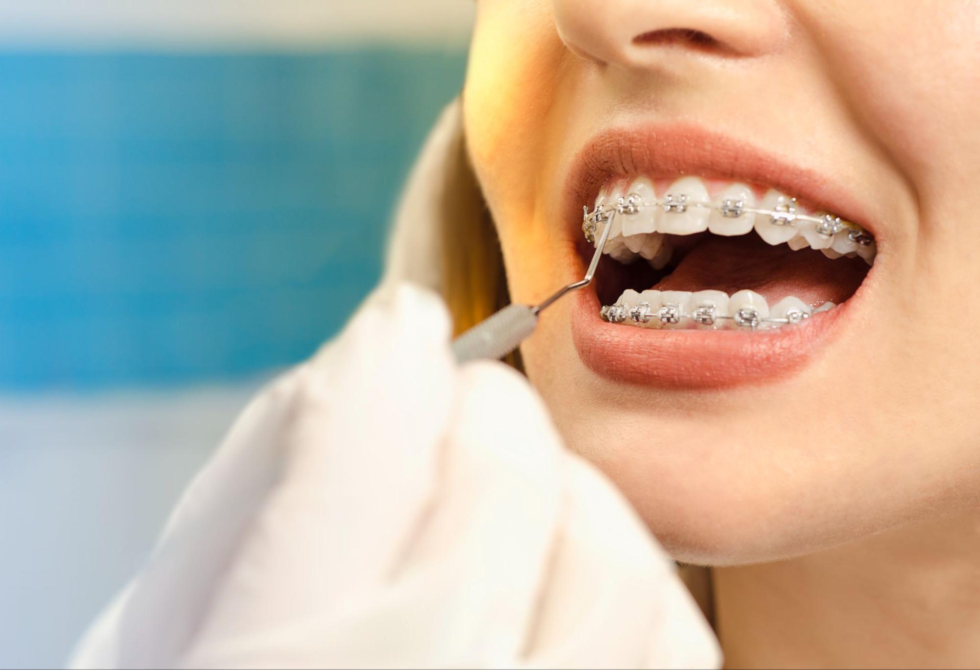 Why Spanish Fork, UT is the Perfect Place for Your Orthodontic Treatment